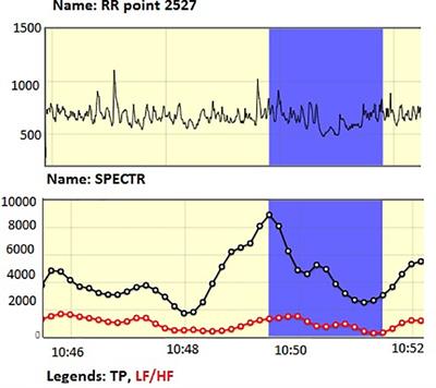 Understanding Emotion-Related Processes in Classroom Activities Through Functional Measurements